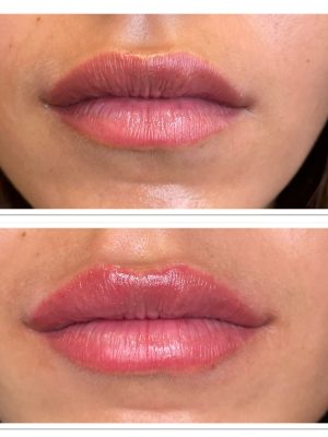 WhatsApp Image 2022-11-24 at 10.54.18