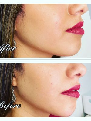 WhatsApp Image 2022-11-24 at 10.54.19